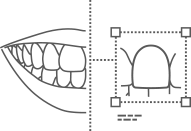A line drawing showing a closeup view of a tooth next to a zoomed out drawing of a mouth