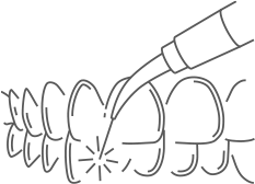 A line drawing depicting the teeth whitening process
